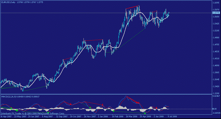 MACD histogram