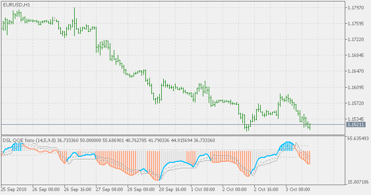 DSL QQE histo