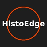 HistoEdge EA MT4