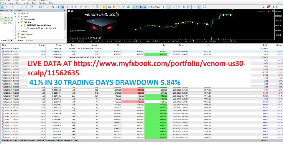 Screenshot #6 Venom Us30 Scalp