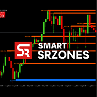 SmartSRZones