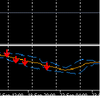Smart Flow Bands