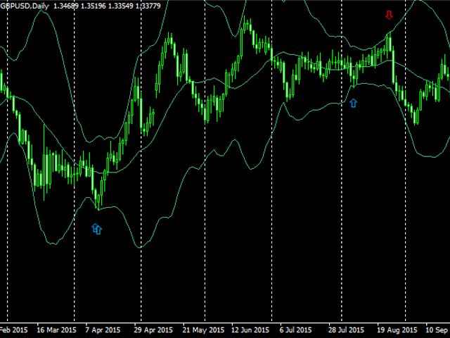 Bollinger Bands: What They Are and How to Use Them