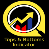 Tops and Bottoms Indicator