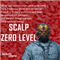 Scalp Zero Level
