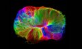 Выращенный в лаборатории миниатюрный мозг самостоятельно соединился со спинным мозгом и мышечной тканью